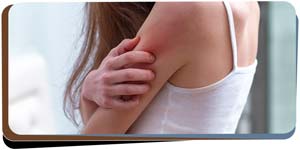 Allergic Reactions Treatment Clinic Near Me in Lehigh Acres, FL